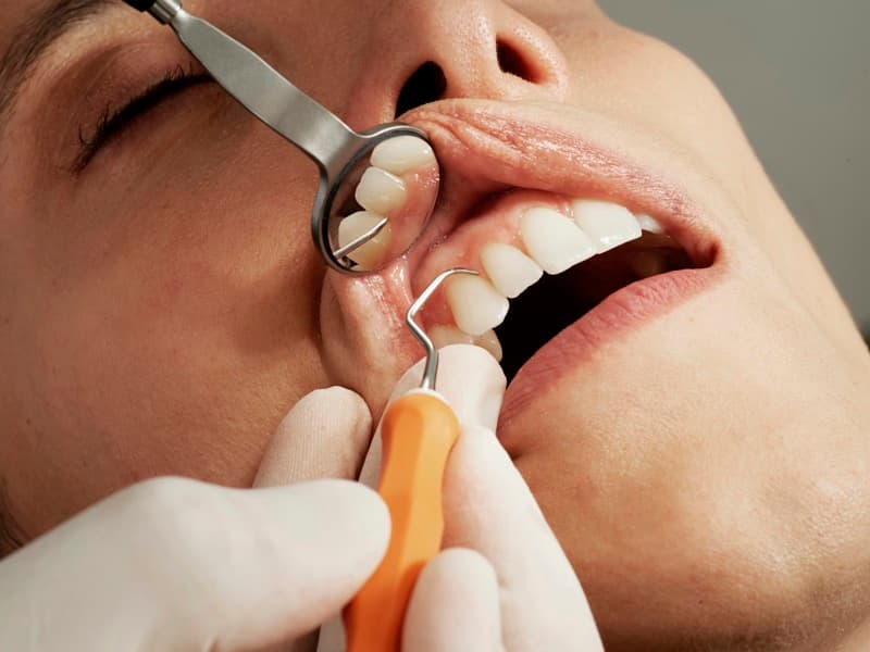 ¿Cada cuánto debes ir al dentista?