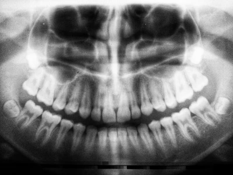 Radiografía dental panorámica digital